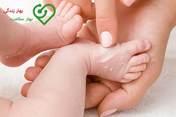 علت سوختگی پای نوزاد با پوشک چیست؟ علت سوختگی پای نوزاد با پوشک چیست؟