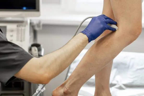 Sonography of leg varicose veins Sonography of leg varicose veins