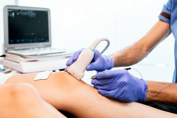 Sonography of leg varicose veins Sonography of leg varicose veins
