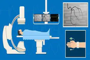 هزینه آنژیوگرافی قلب آپدیت مرداد 1405